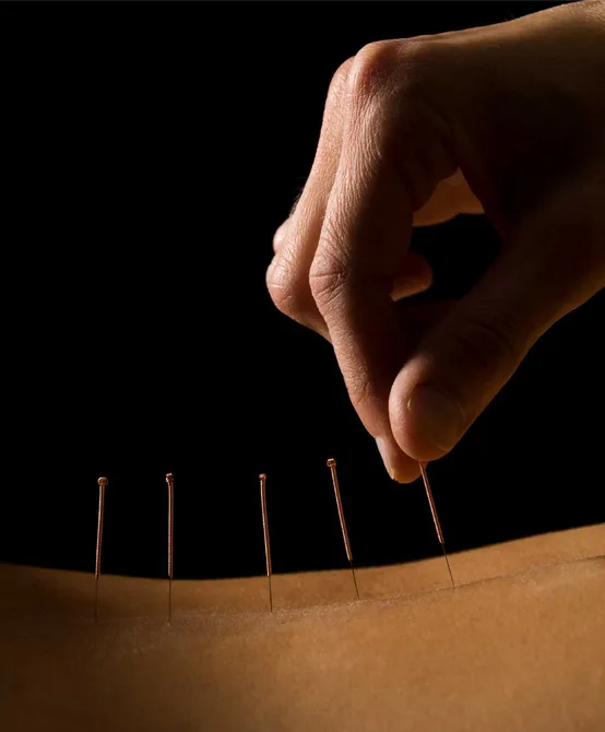 Acupuncture & Meridian Therapy