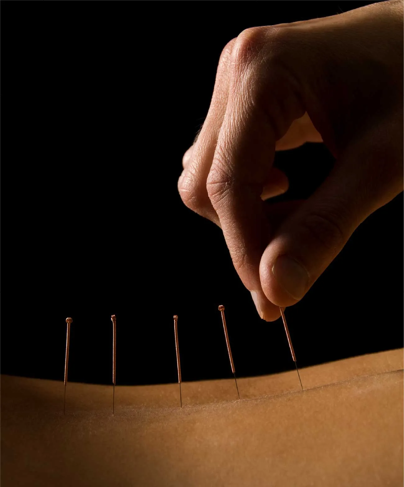 Acupuncture & Meridian Therapy